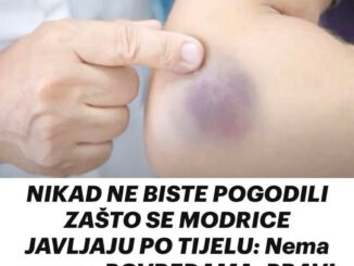 Modrice su čest fenomen koji se javlja