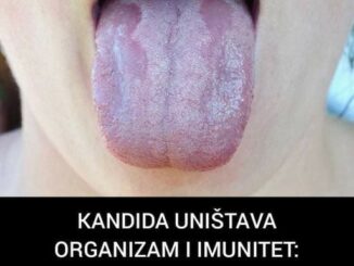 Candida Albicans je najčešći